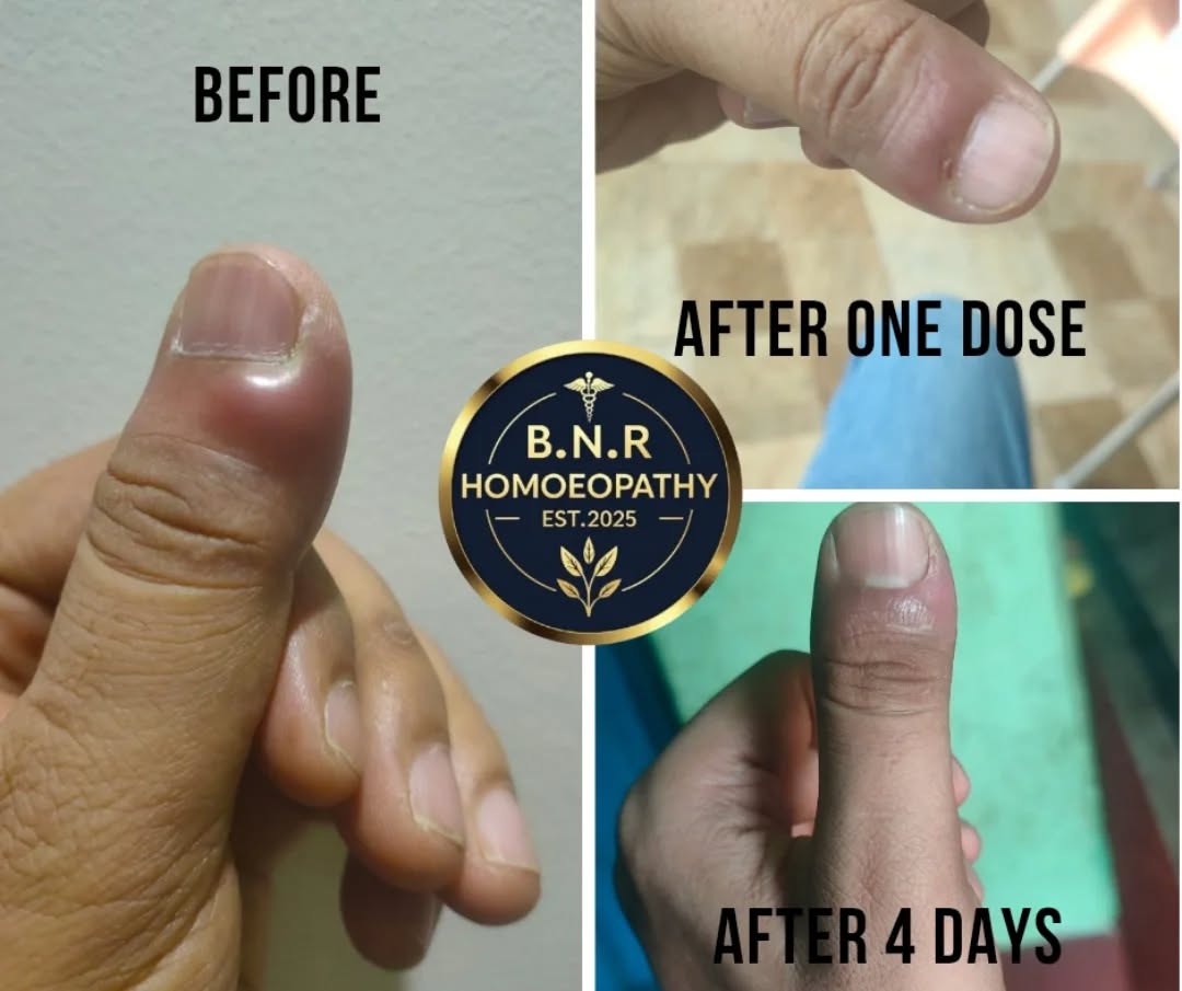 Comfortable Patient Recovery Room